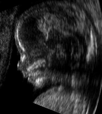 Embryo 14 Wochen alt